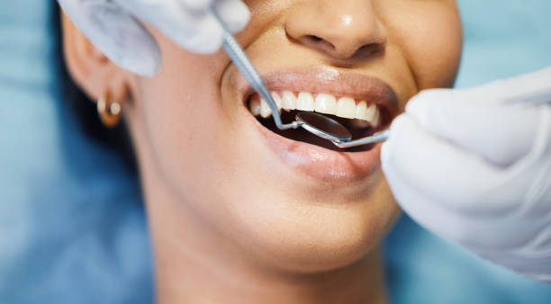 Best Dental Abscess Treatment in Spring City, UT